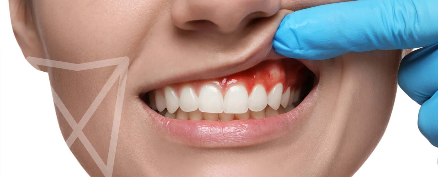 Tag der Parodontologie